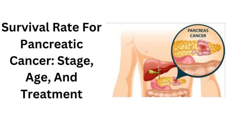 Survival Rate For Pancreatic Cancer: Stage, Age & Treatment