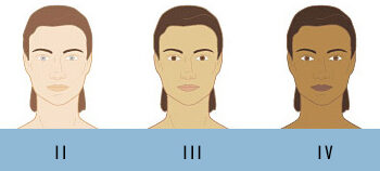 Laser Hair Removal Toronto