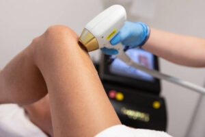 Laser Hair Removal Abu Dhabi