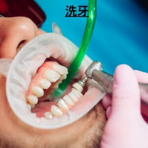 洗牙