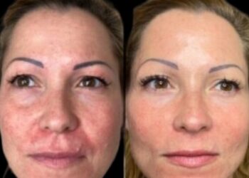 Best Aesthetic Clinic in dubai