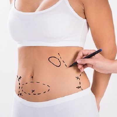 شد البطن في مسقط