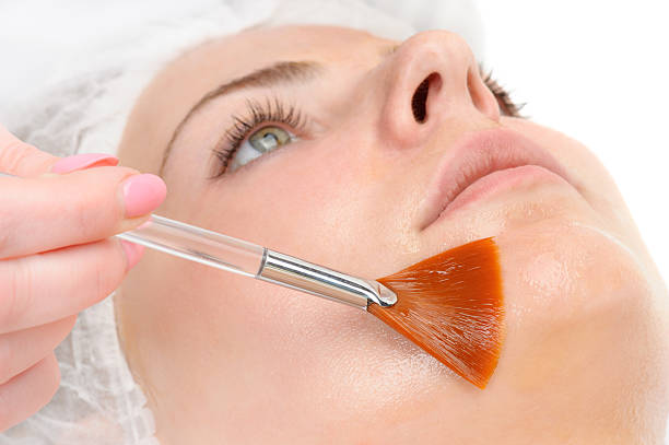 Chemical Peels in Dubai