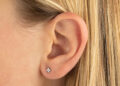 Can Ear Piercing Trigger Skin Conditions Like Keloids?