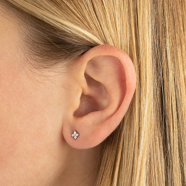 Can Ear Piercing Trigger Skin Conditions Like Keloids?
